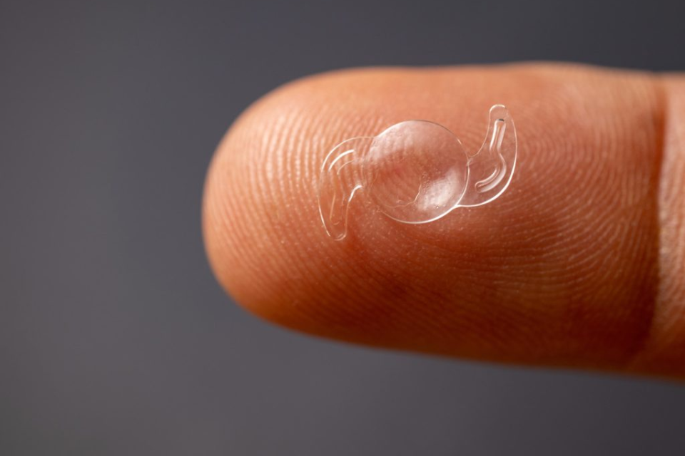 Lente intraocular santa marta